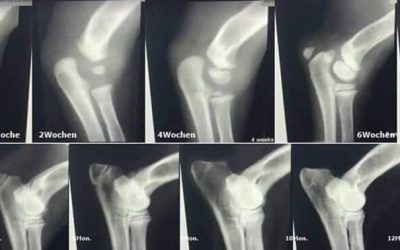 Displasia del ginocchio Patella lux
