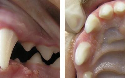 Difetti di chiusura dentale: prognatismo ed enognatismo
